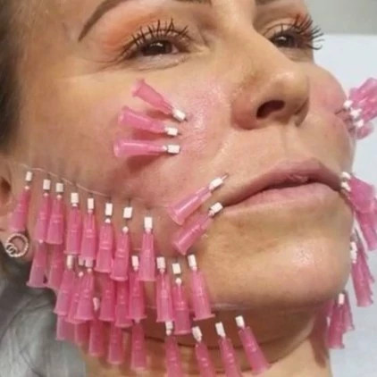 نخ لیفت مونو 20 عدد برند NVL