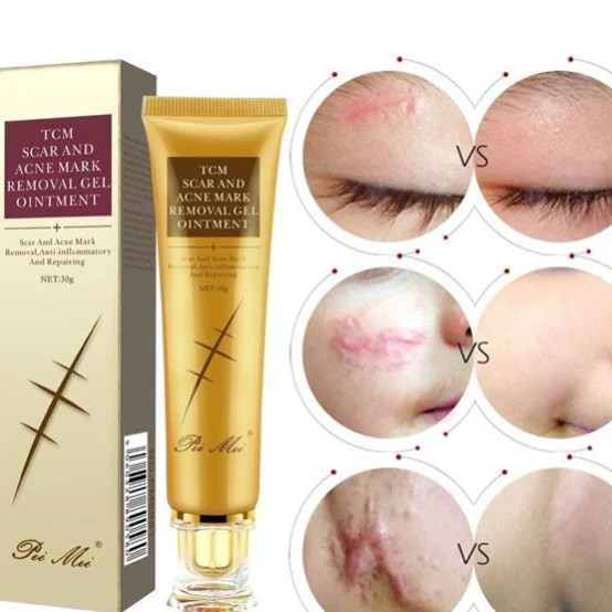 ژل رفع جای آکنه و اسکار Pei Mei TCM حجم 30ml ضد التهاب و ترمیم سریع