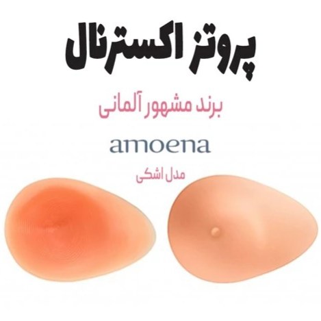 پروتز اکسترنال سینه