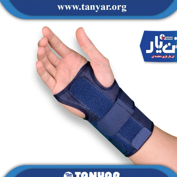 مچ بند آتل دار ابری تن یار