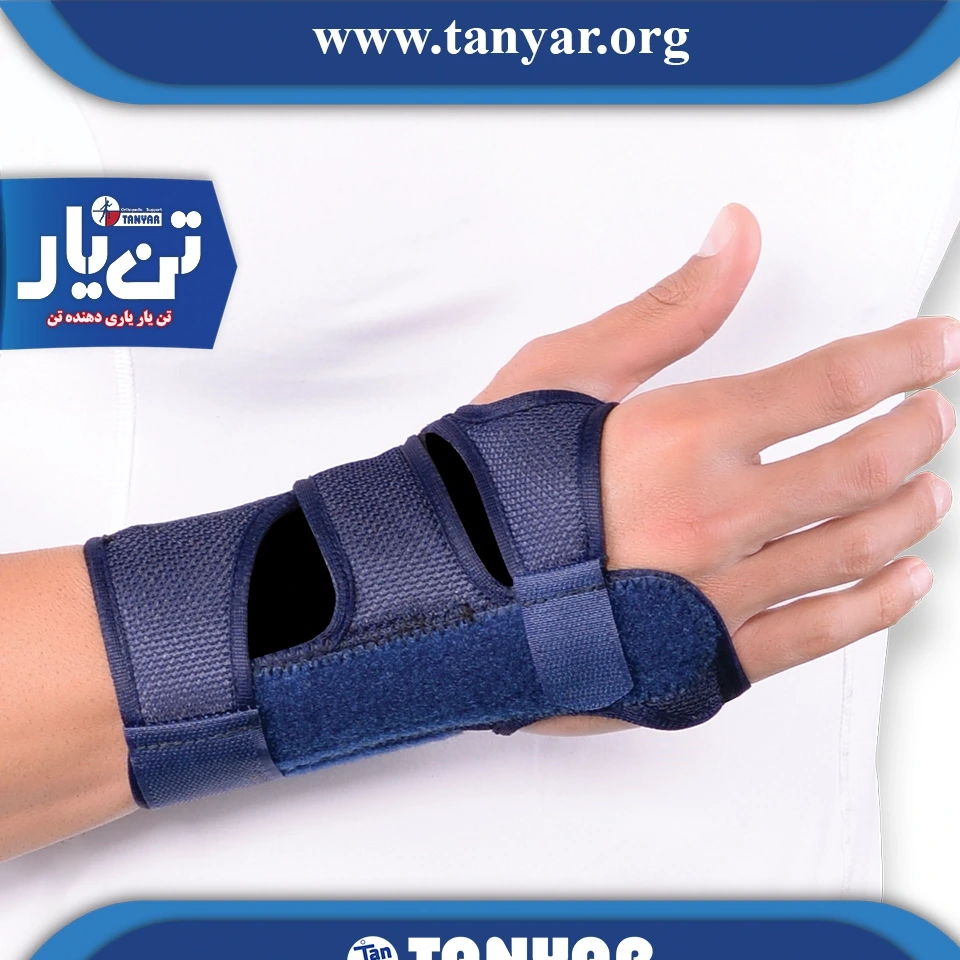 مچ بند آتل دار ابری تن یار